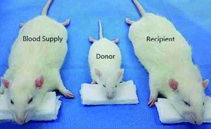 医学界掀起换头热:小鼠已成功 人类还有多远？