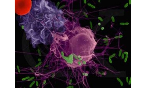 癌症患者福音?日本启动首个“癌症光免疫疗法