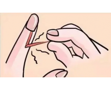 指甲长到刺是缺维生素吗 蚂蚁庄园长倒刺11月1